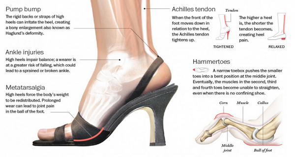 Side-Effects-From-High-Heels-